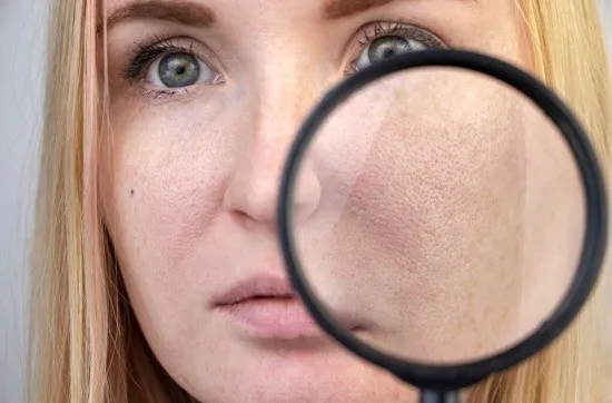 🌸انترفارما | طرق علاج المسام الواسعة بفعالية